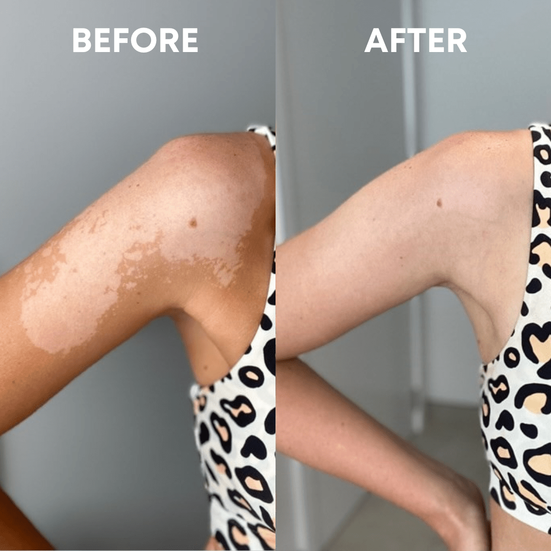 SmoothBuff™ Body Exfoliating Glove